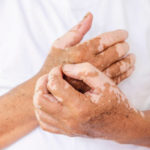 Prendre soin de ses mains malgré les conditions dermatologiques